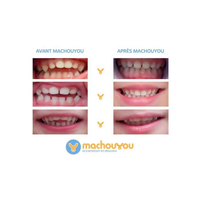 Machouyou Dispositif 1eres dents couleur - Orange